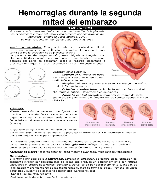 Hemorragia de la segunda mitad del  - pdf 